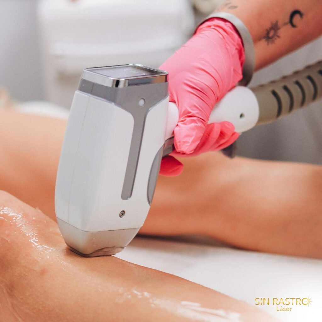 Todo lo que necesitas saber antes (y después) de tu Depilación Láser en Coslada